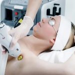 Woman wearing protective eyewear receiving laser hair removal treatment on her underarm with a Candela laser device operated by a medical professional.