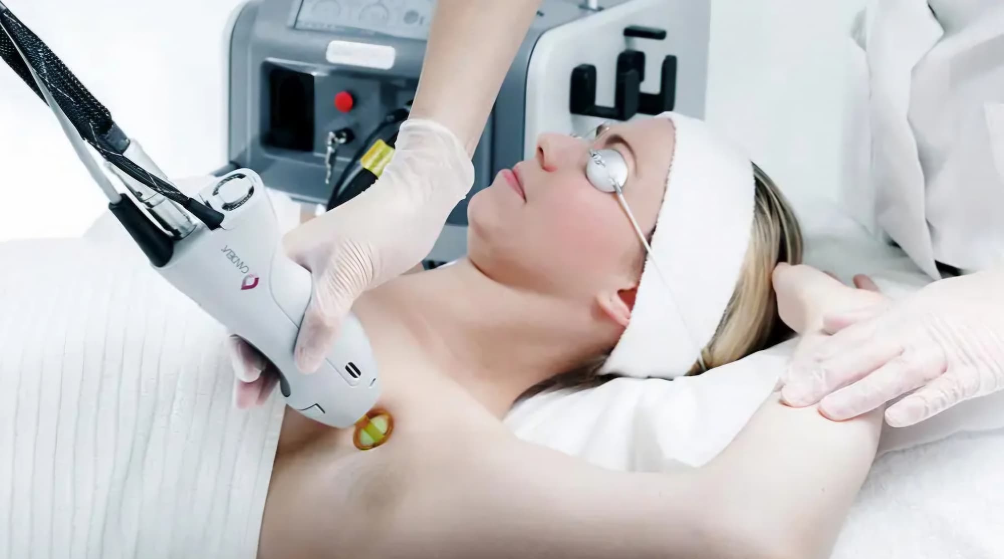 Woman wearing protective eyewear receiving laser hair removal treatment on her underarm with a Candela laser device operated by a medical professional.