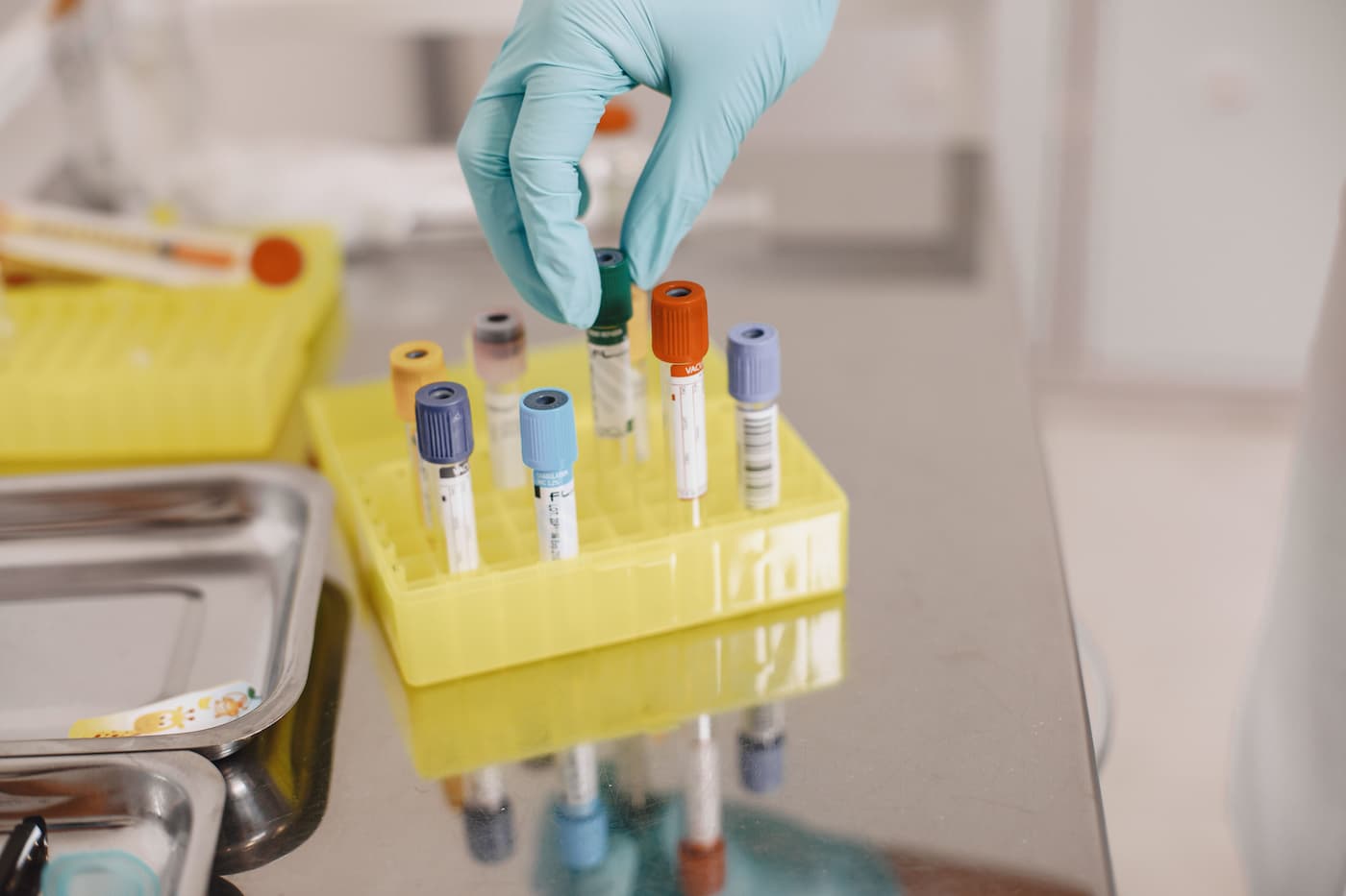 Medical professional wearing blue gloves handling blood collection tubes with color-coded caps in a laboratory sample rack for diagnostic testing.