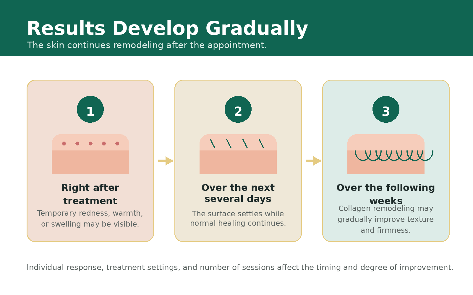Three-stage infographic illustrating RF microneedling recovery, from temporary redness and swelling immediately after treatment to skin healing over several days and gradual collagen remodeling over the following weeks.