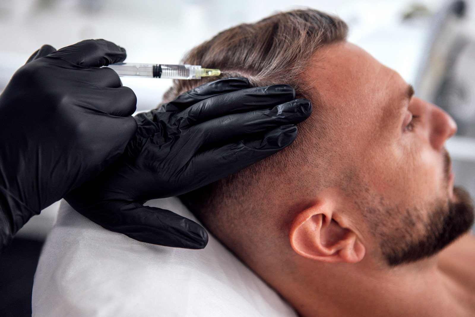 Close-up of a medical professional wearing black gloves administering an injection along a man's thinning hairline during a non-surgical hair restoration treatment.