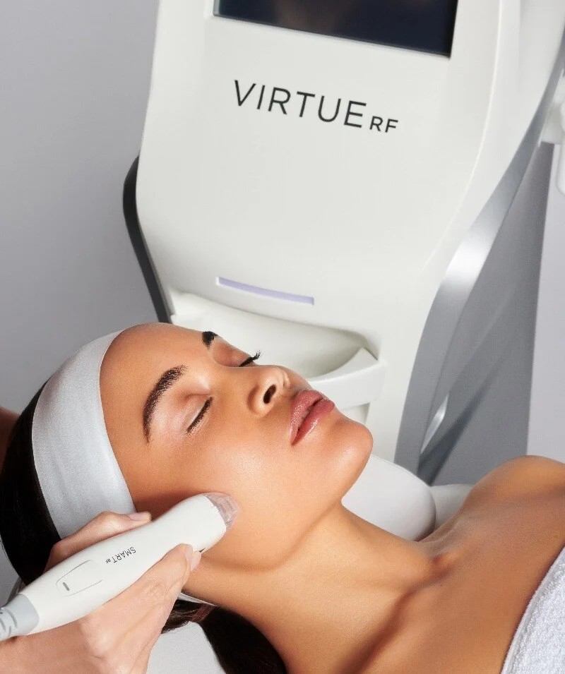 Woman receiving RF microneedling treatment on her cheek using the VirtueRF SmartRF handpiece, with the VirtueRF device visible behind her.