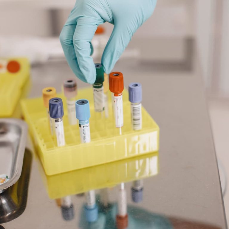 Medical professional wearing blue gloves handling blood collection tubes with color-coded caps in a laboratory sample rack for diagnostic testing.