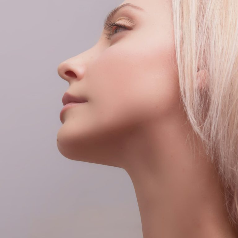 Side-profile portrait of a blonde woman highlighting a softly defined jawline and lower facial contours associated with cosmetic masseter slimming treatments.